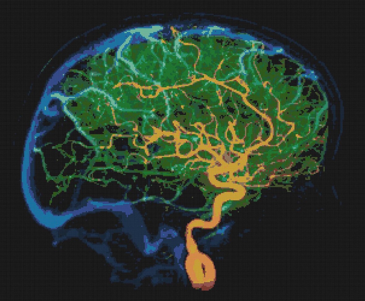 Brain Blood Vessels Cross-Stitch Pattern https://www.etsy.com/listing/210943795/brain-blood-vessels-pdf-handmade-cross?ref=shop_home_active_1